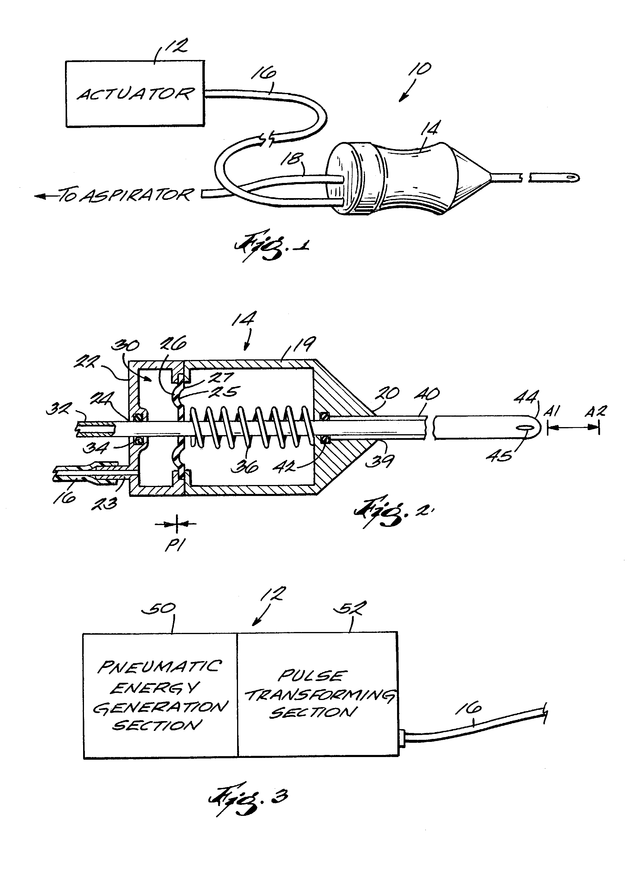 High-speed vitreous cutting system