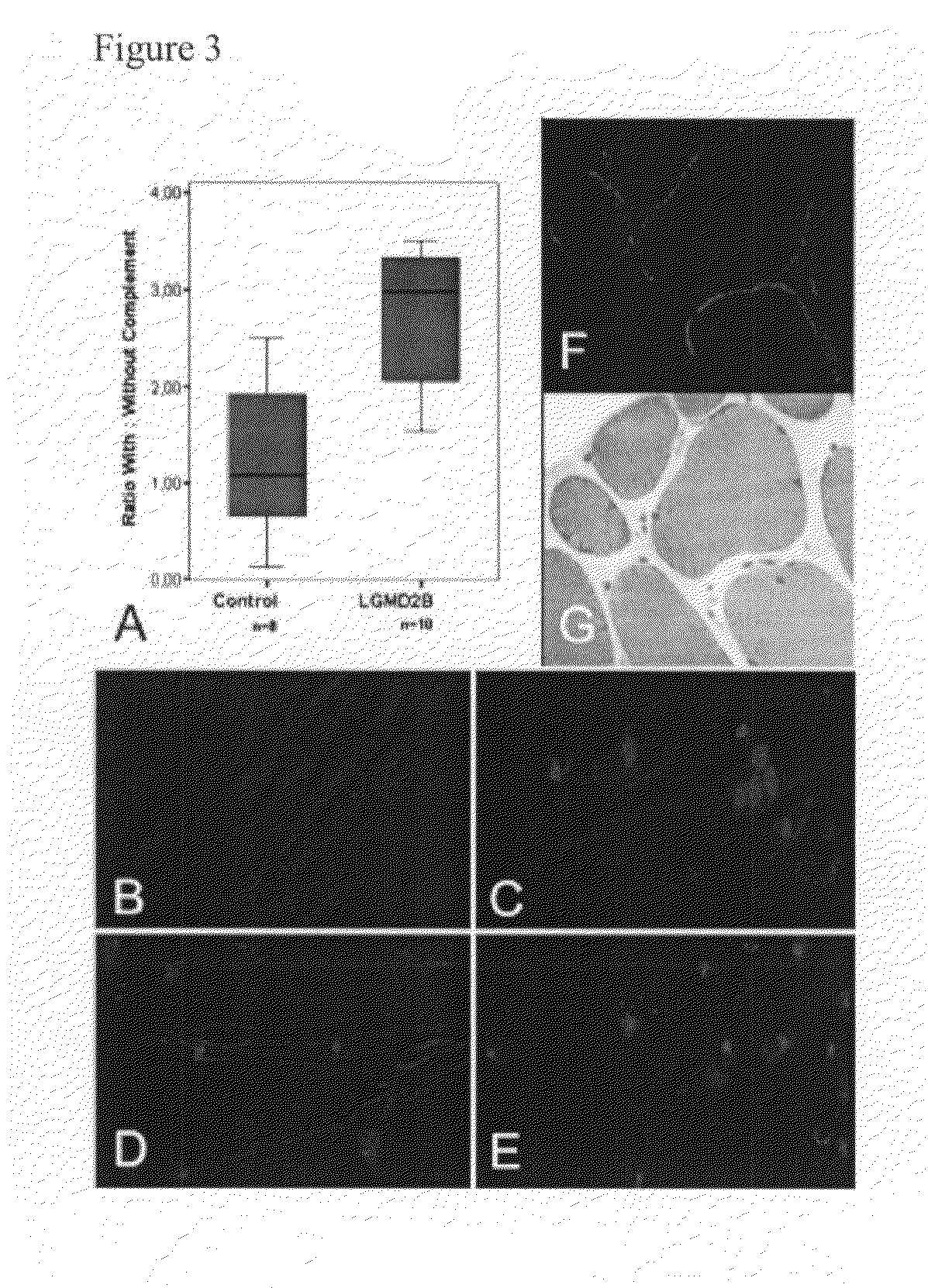 Methods for the treatment of muscular dystrophy associated with dysferlin-deficiency