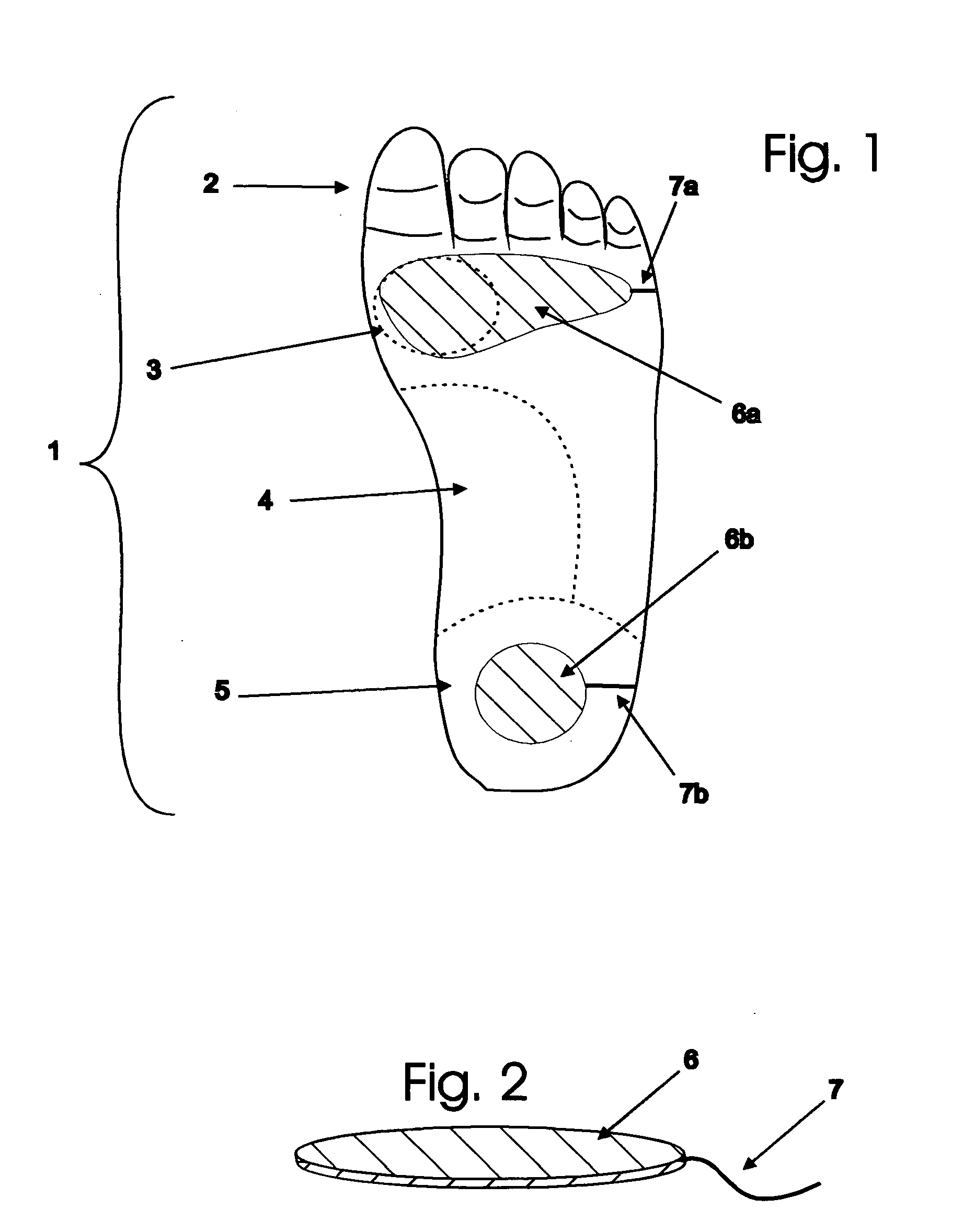 Neuromuscular electrical stimulation of the foot muscles for prevention of deep vein thrombosis and pulmonary embolism with motion detection control