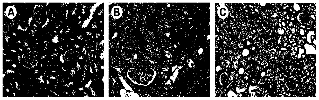 Composition for preventing and/or treating chronic kidney disease and preparation method and application thereof