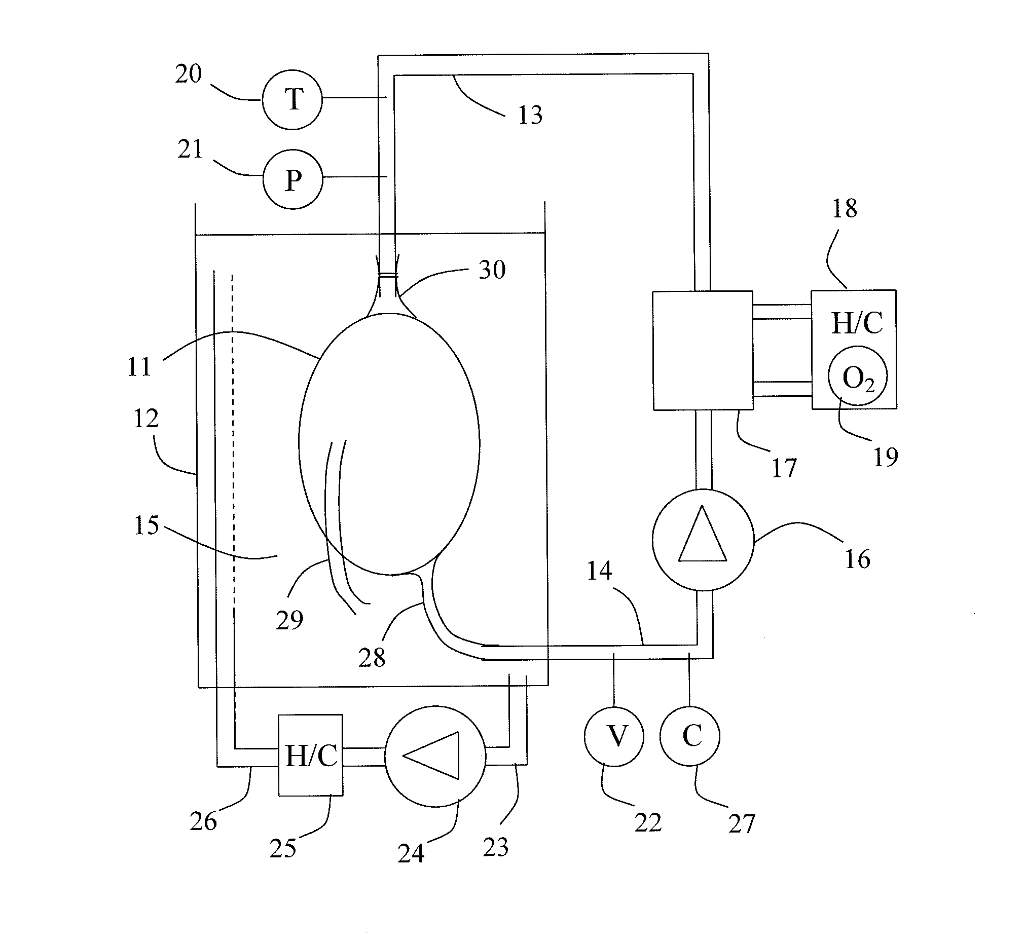 Method, device and fluid for treatment of a heart after harvesting