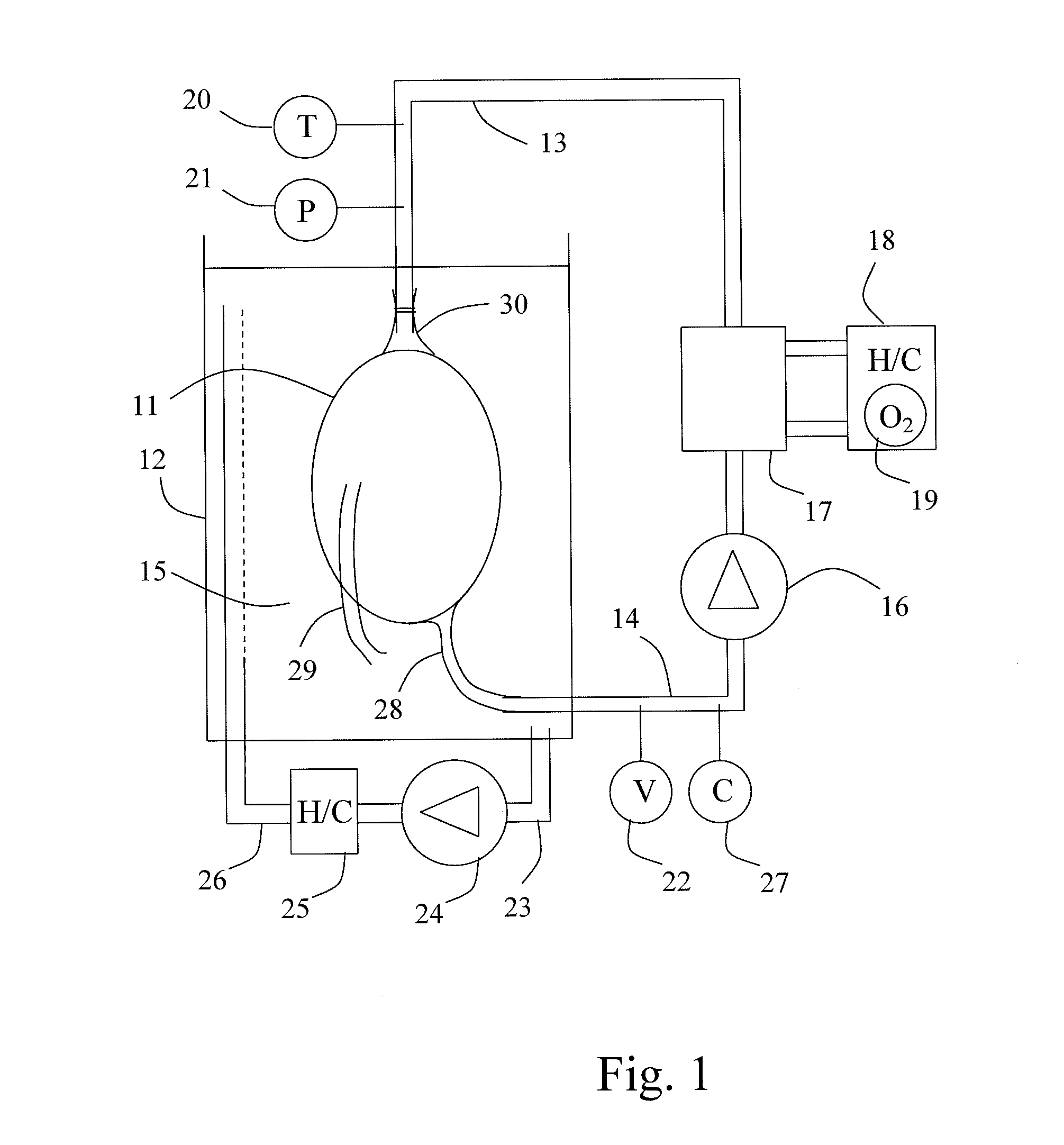 Method, device and fluid for treatment of a heart after harvesting