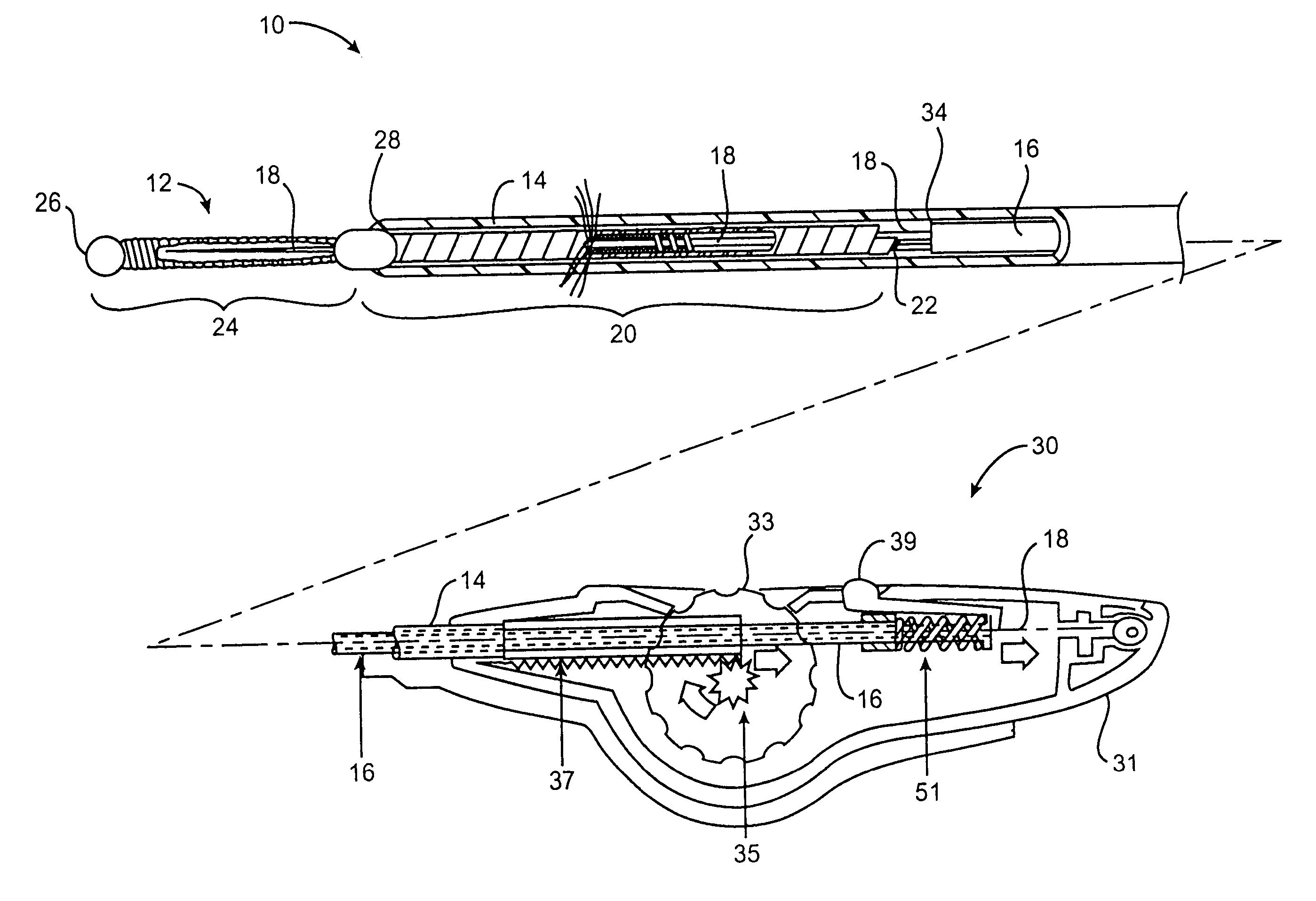 Deployment actuation system for intrafallopian contraception