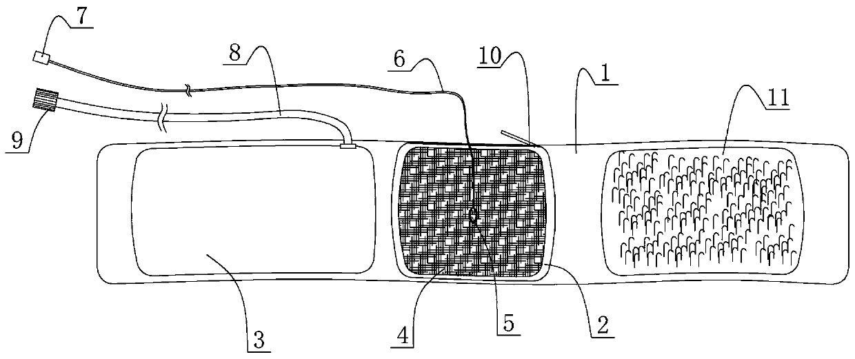 Detumescence device for peripheral area of punctured part in cardiovascular disease interventional diagnosis and treatment