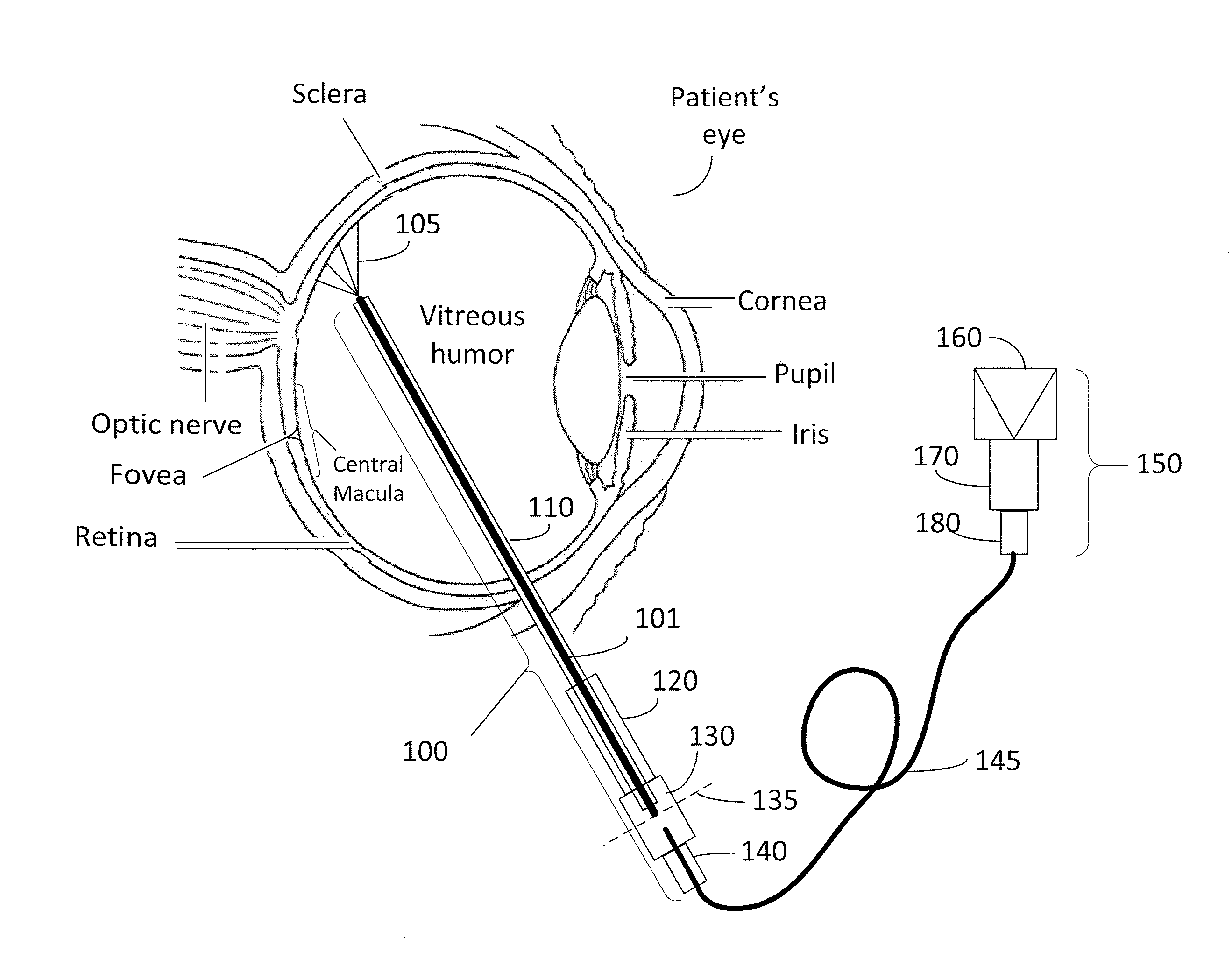 Grin fiber multi-spot laser probe