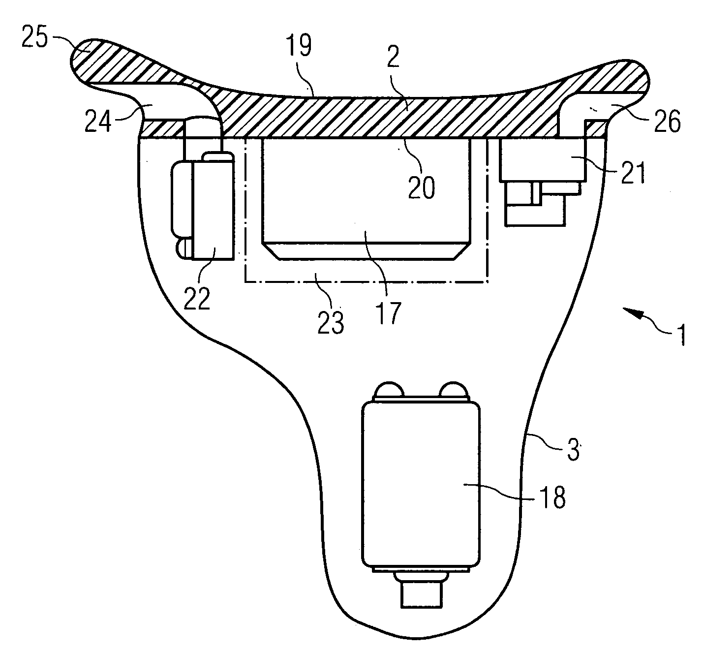 Hearing device with a contact unit and an associated external unit