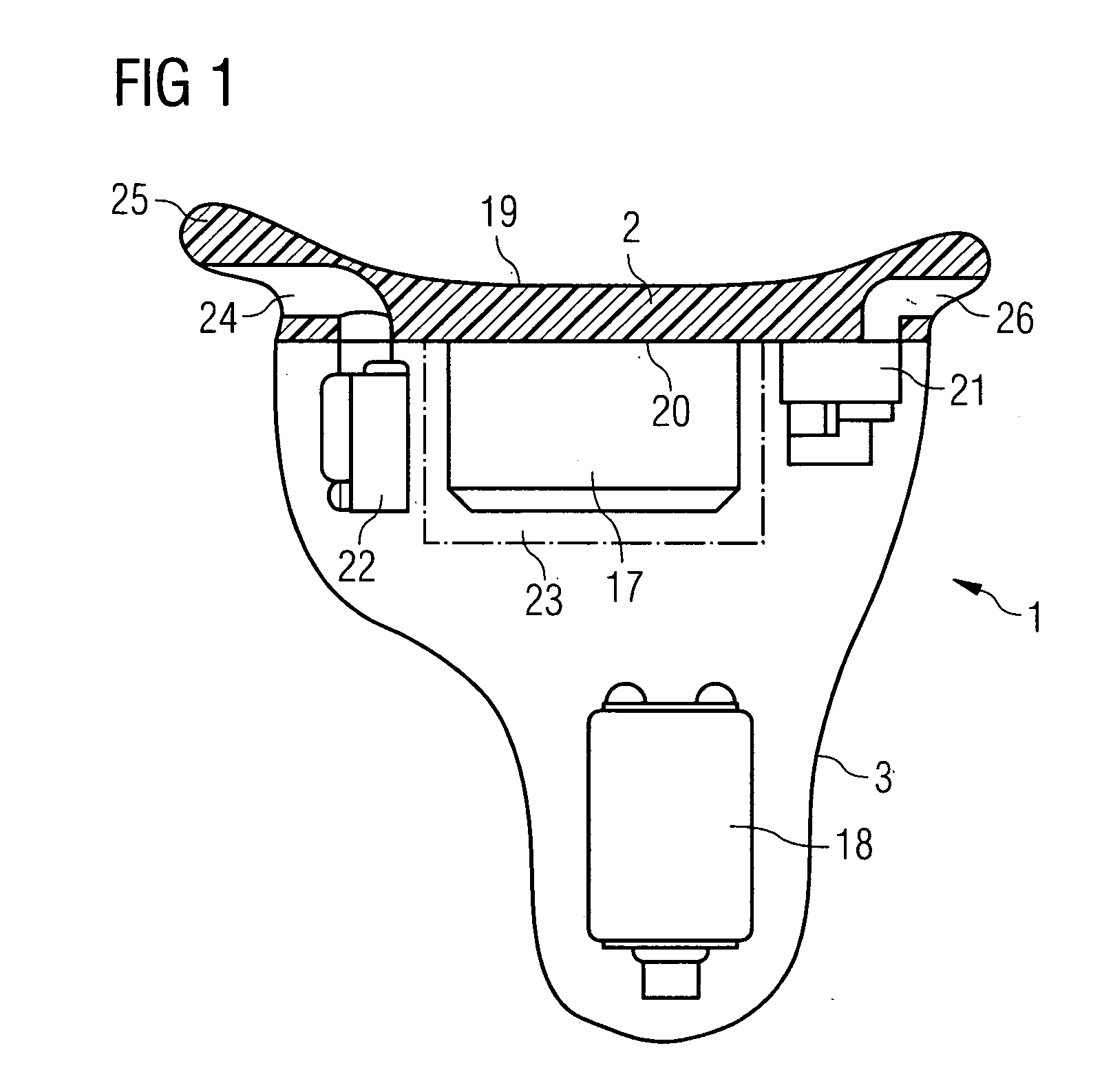 Hearing device with a contact unit and an associated external unit