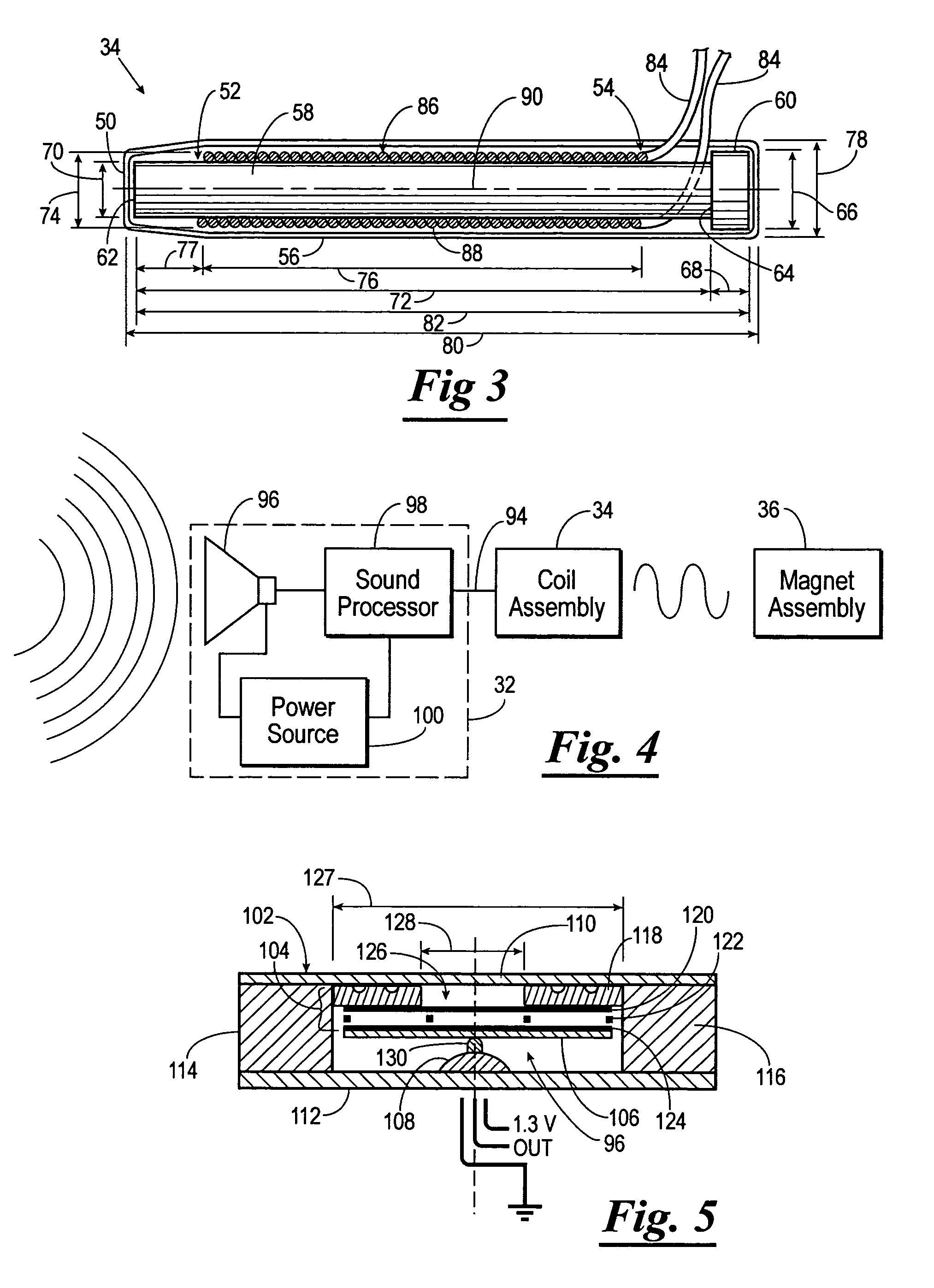 Totally implantable hearing system