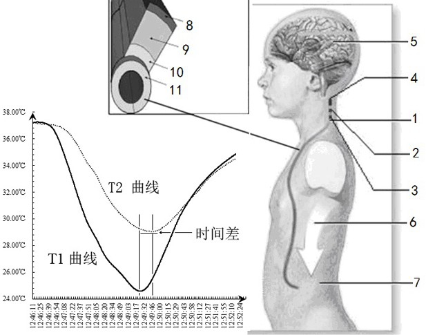 Cerebrospinal fluid shunt flow detection method