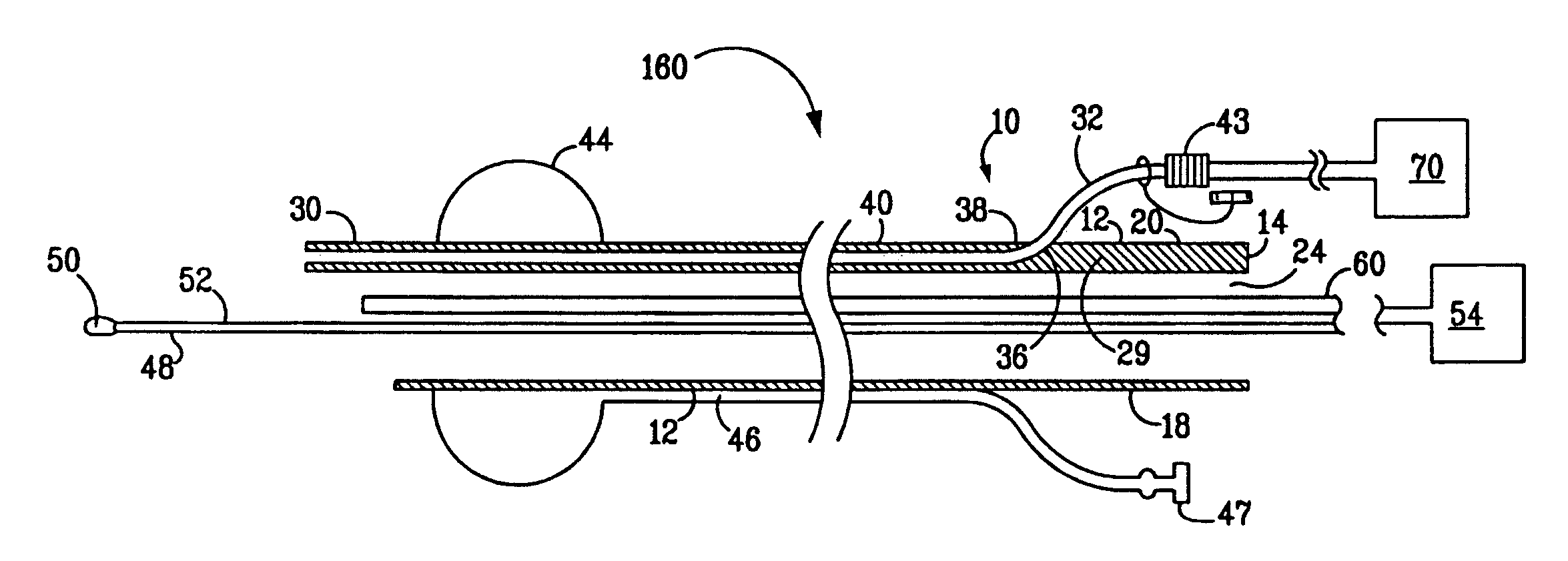 Jet endotracheal device and its use in intubation