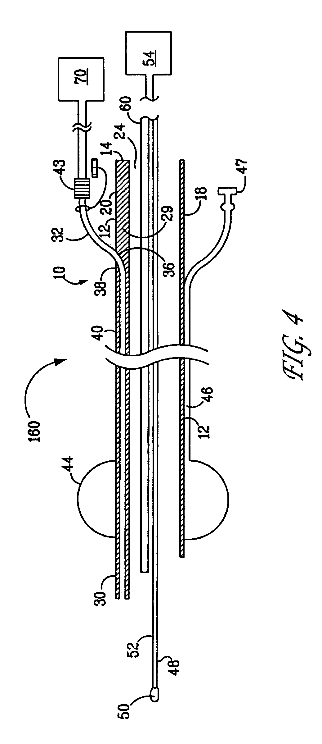 Jet endotracheal device and its use in intubation