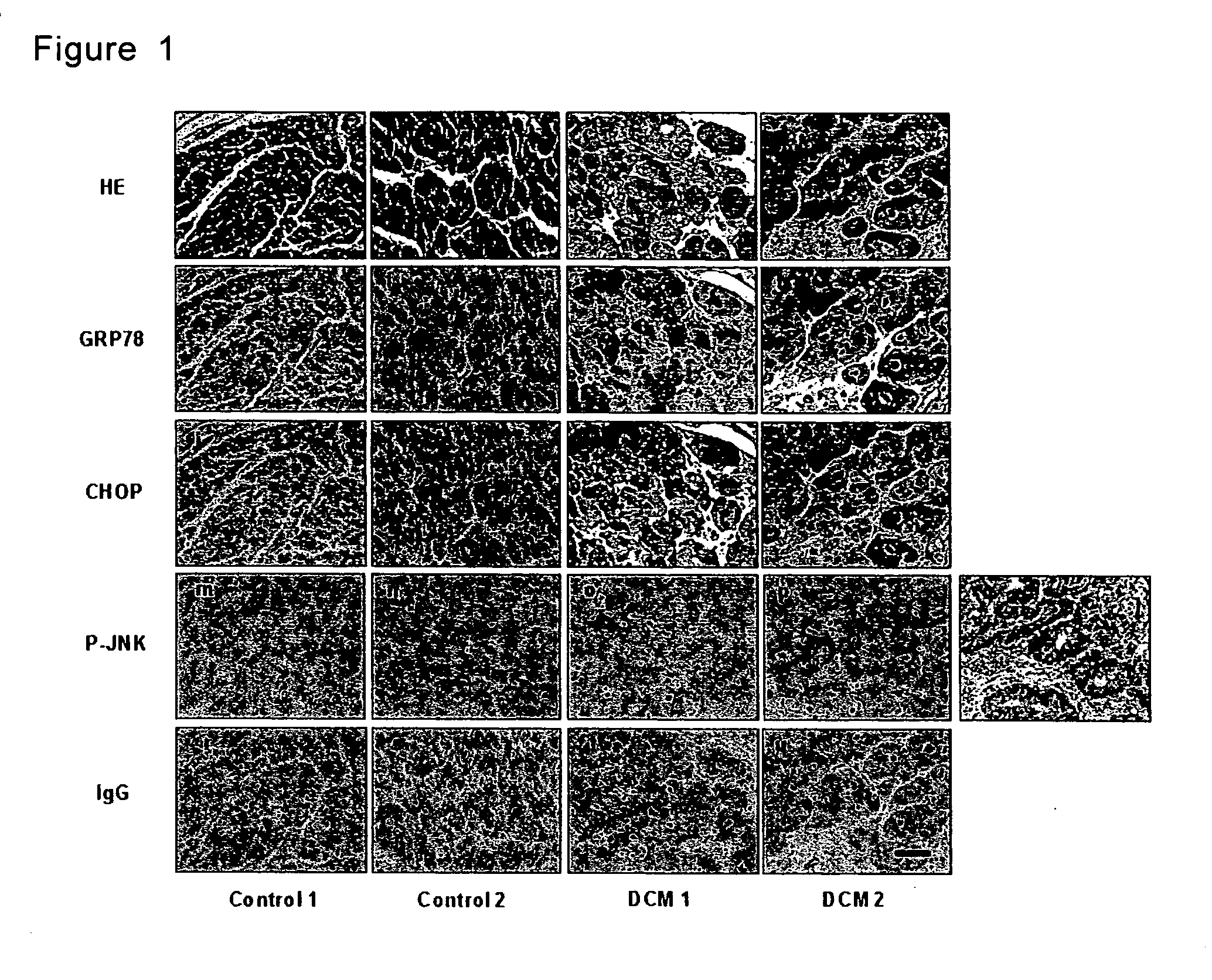 Method for diagnosis of heart failure