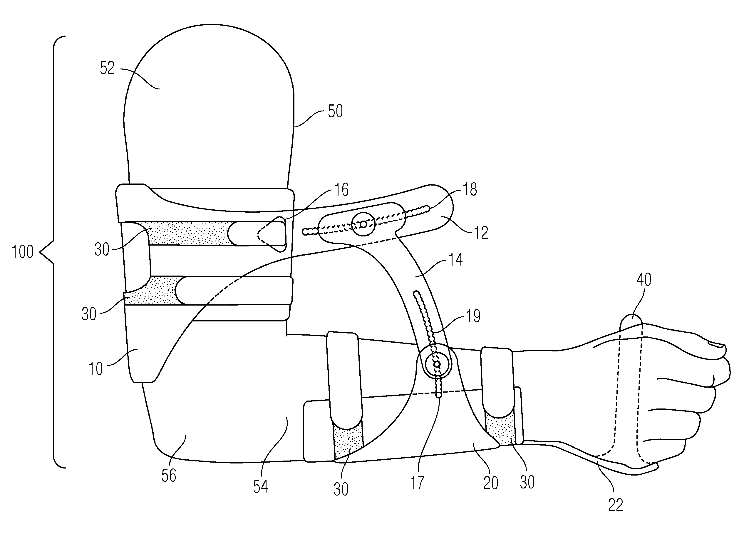 Extremity Support Apparatus and Method