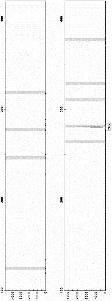 Amplification composite for detecting microdeletion of Y-chromosome and detection kit