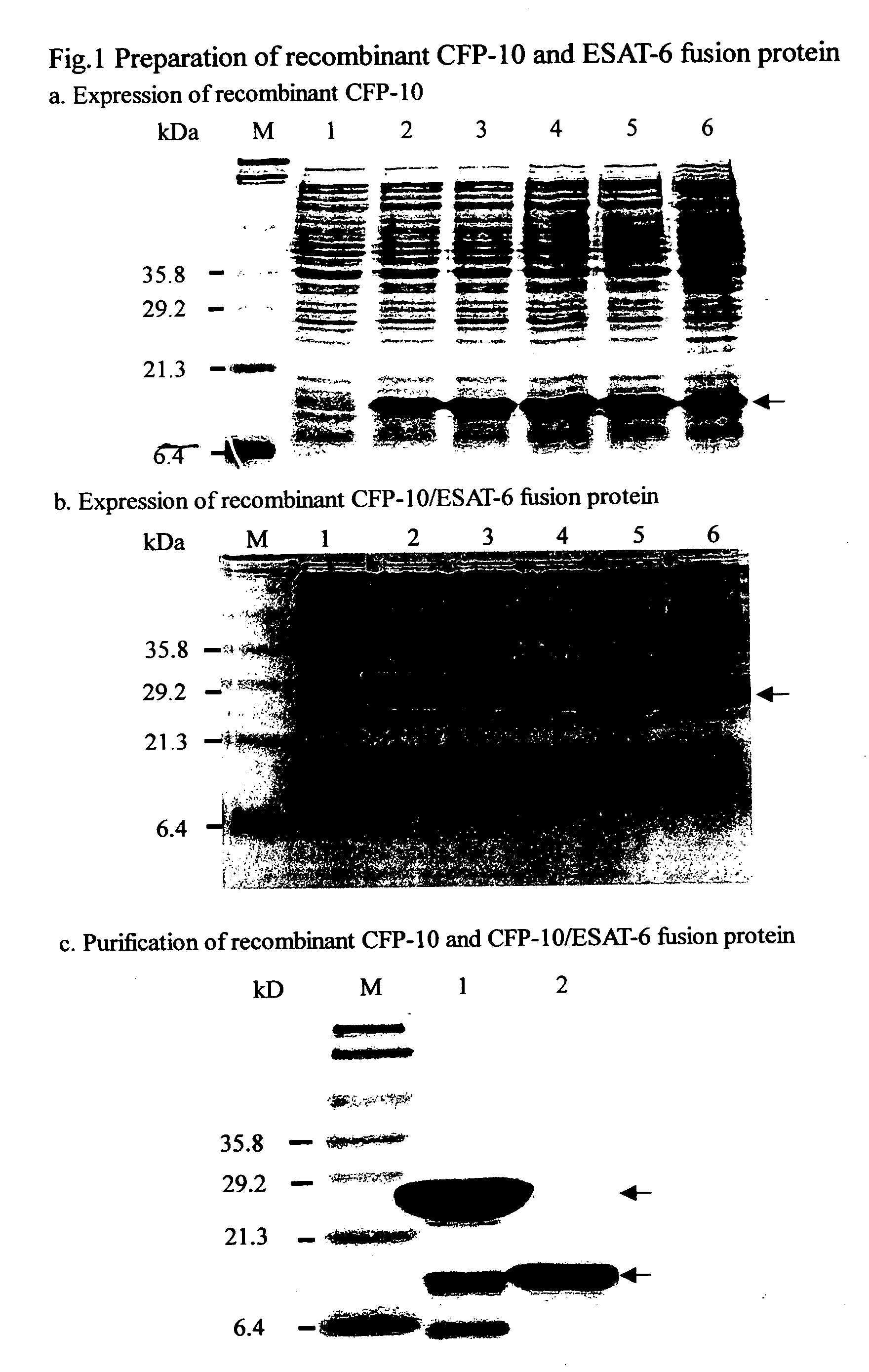 Method for detection of Mycobacterium tuberculosis antigens in biological fluids