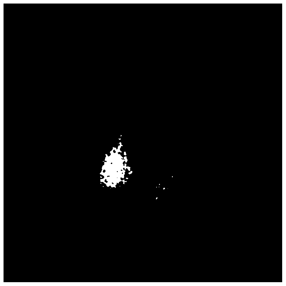 Thyroid nuclear medicine image diagnosis method based on deep learning