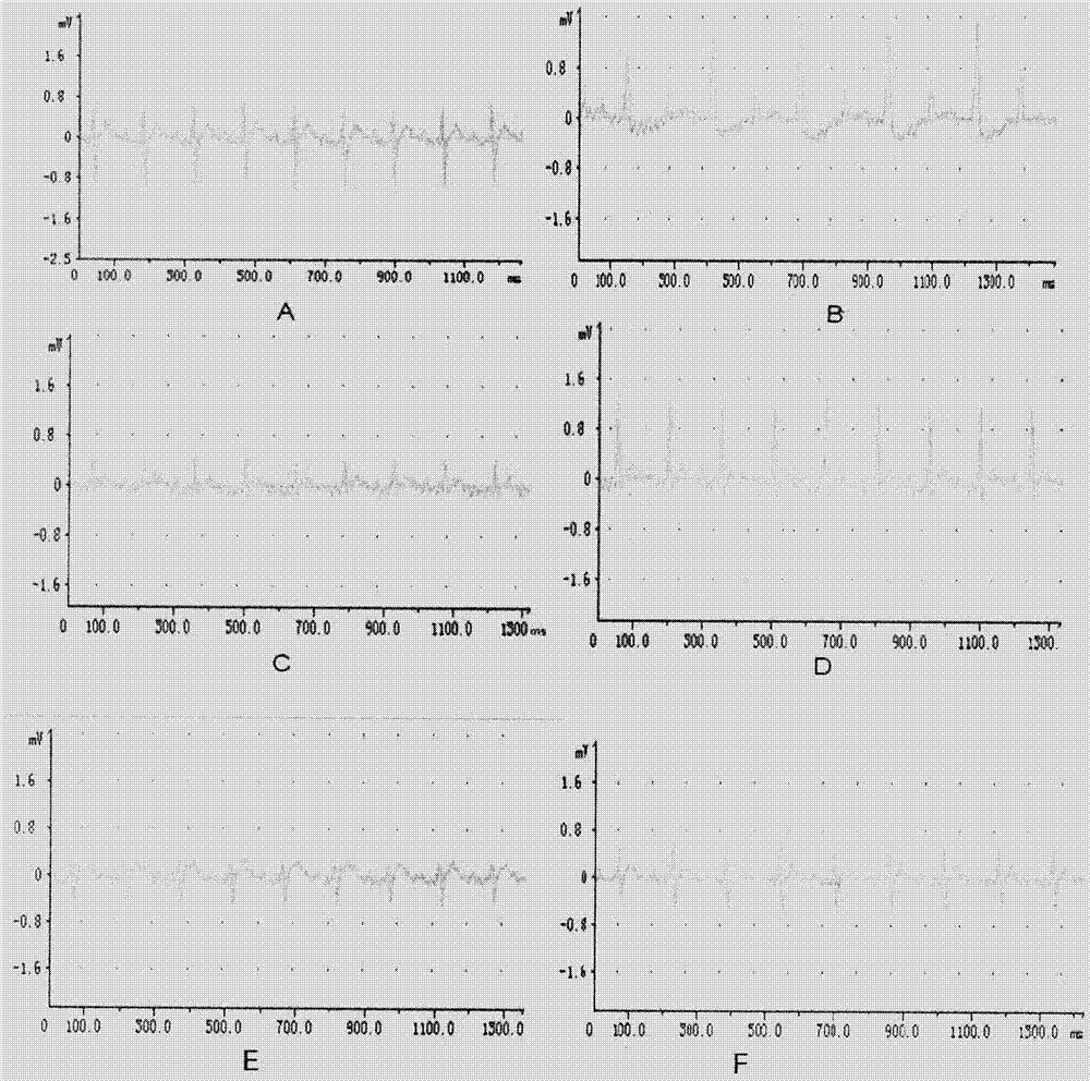 Application of rutin medicines to preparing medicines for preventing or treating medicine-induced cardiac toxicity