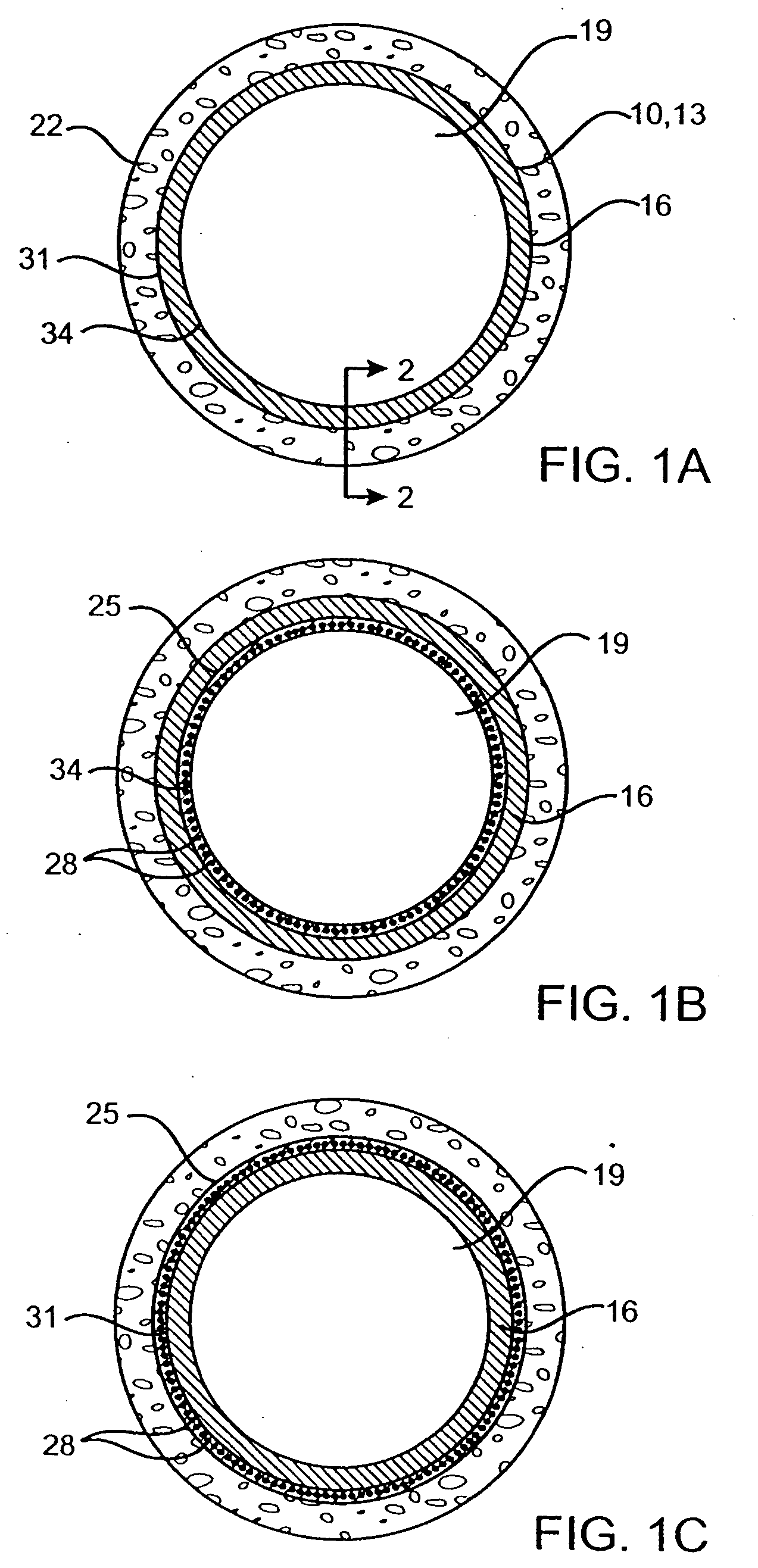 Delivery of therapeutic capable agents