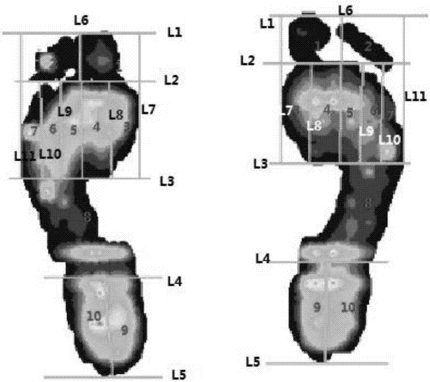 Plantar pressure analysis method