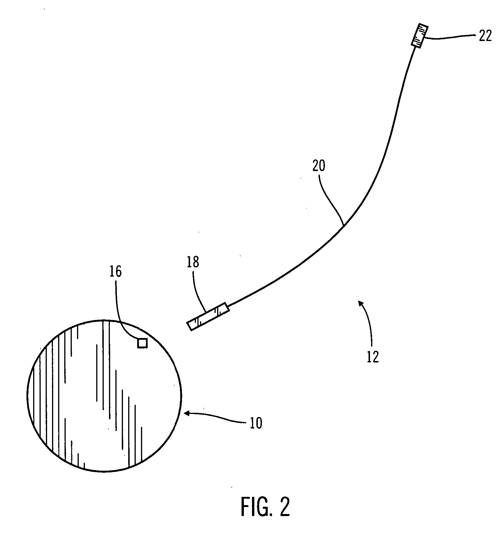 Method and system for non-vascular sensor implantation