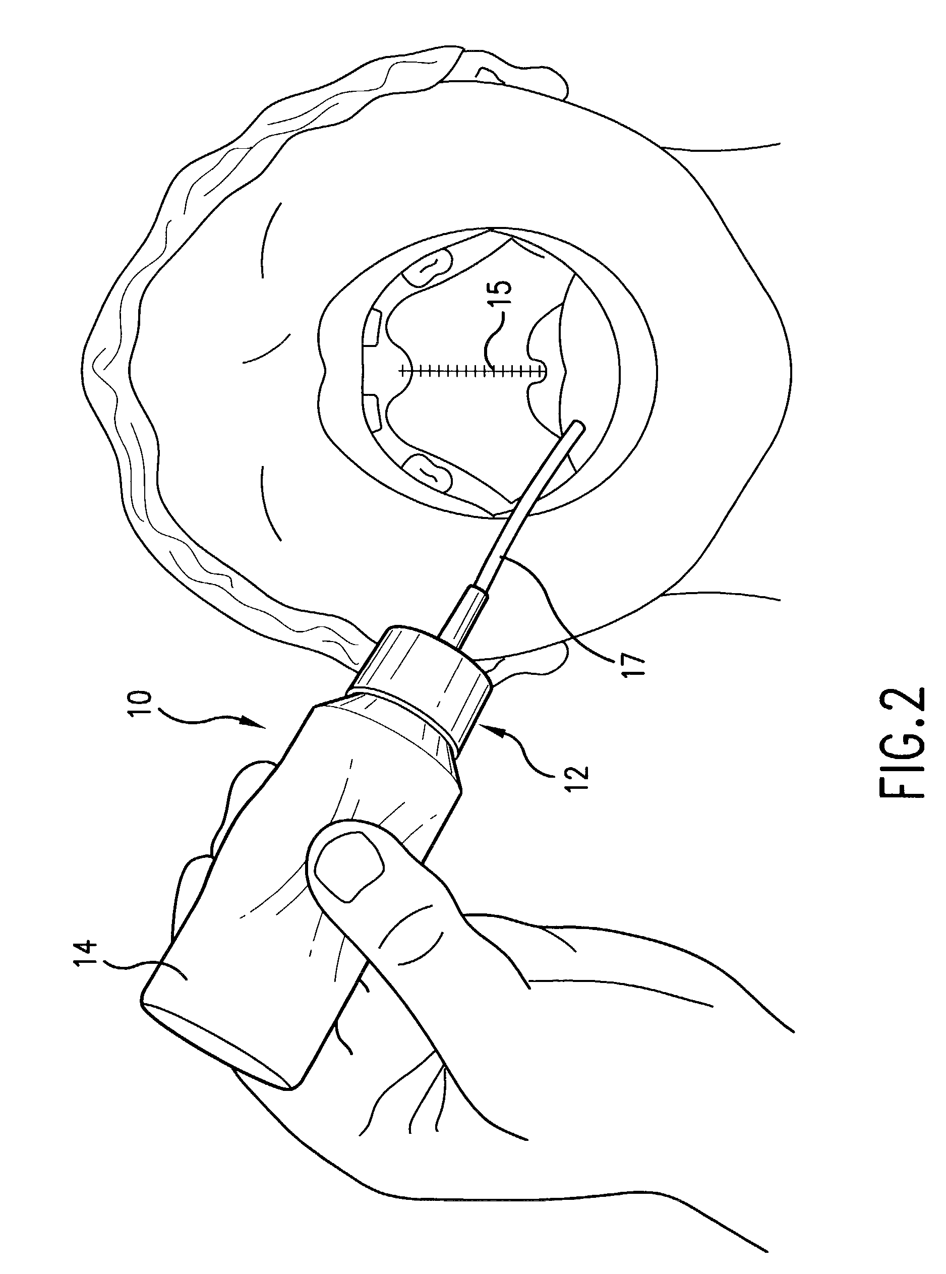 Squeezable, fillable feeding device