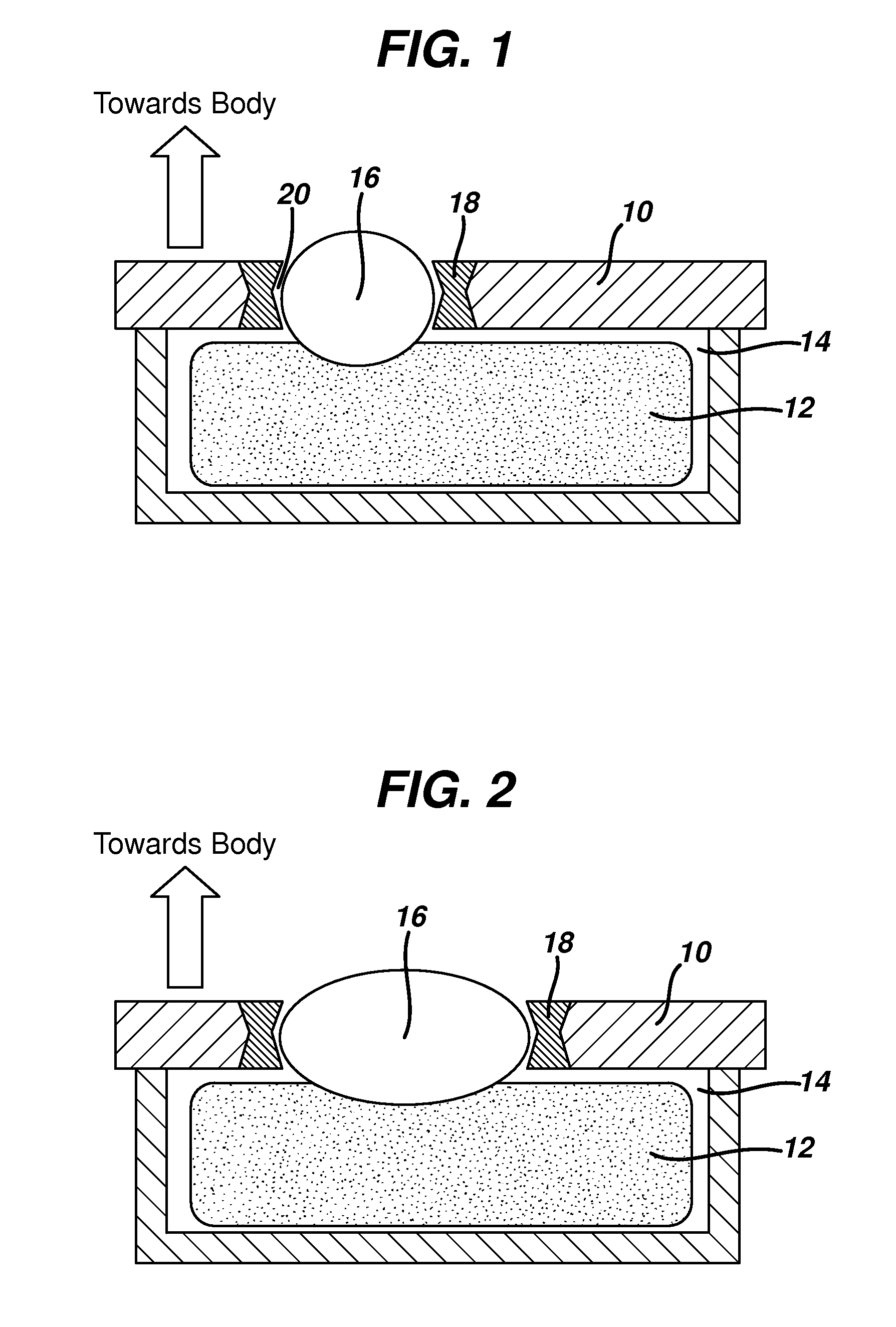 Thermal treatment device