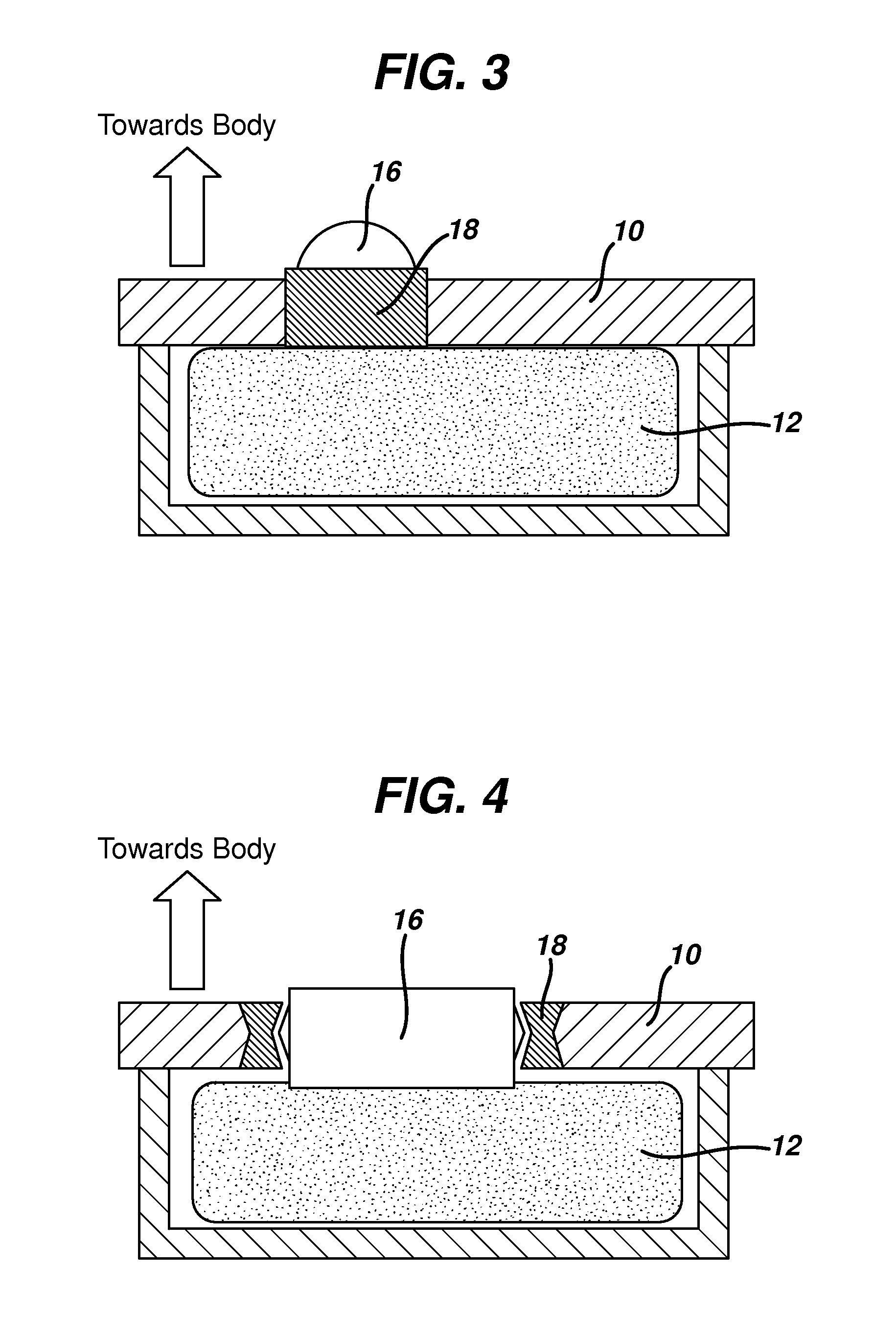 Thermal treatment device