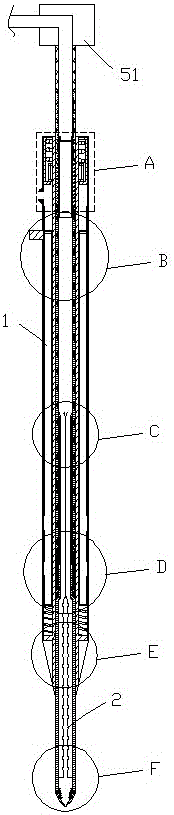 A rapid deflation and elimination device for treating rumen gas