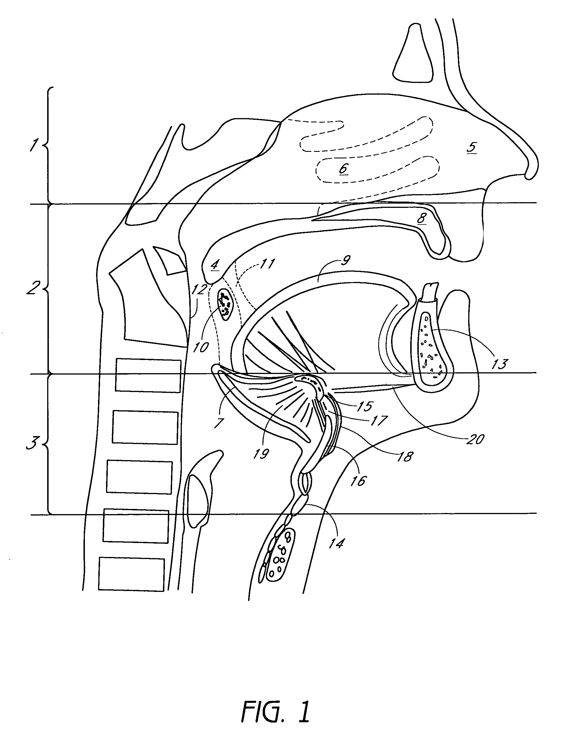 System for adjustable tissue anchors