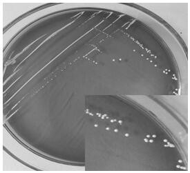 A strain of Lactobacillus plantarum capable of lowering cholesterol and promoting the production of intestinal short-chain fatty acids and its application