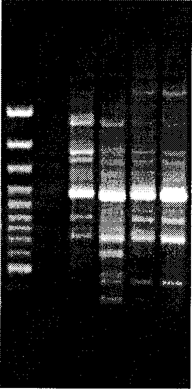 Model construction of human flora-associated piggy and molecular method for detecting flora in intestine tract of baby pig