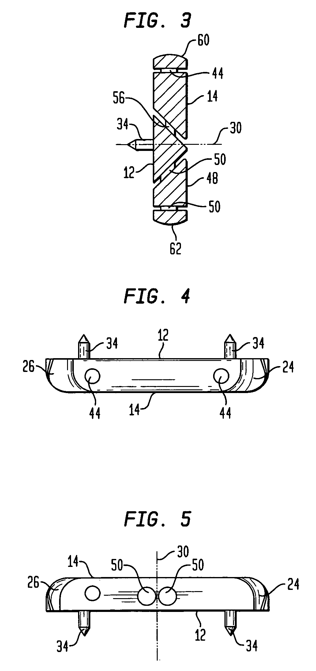 Bone shaped cutting block