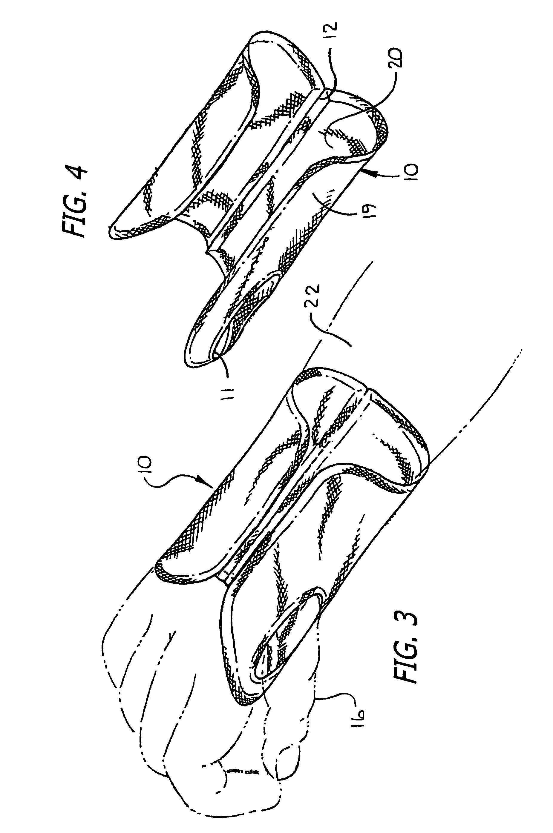 Versatile hardenable cast or support