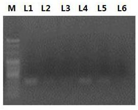 Prostate cancer early diagnosis or prognosis assessment marker lncRNA malat1 and its application