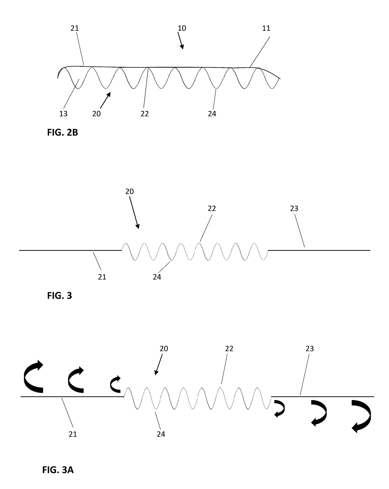 Structurally enhanced tissue graft