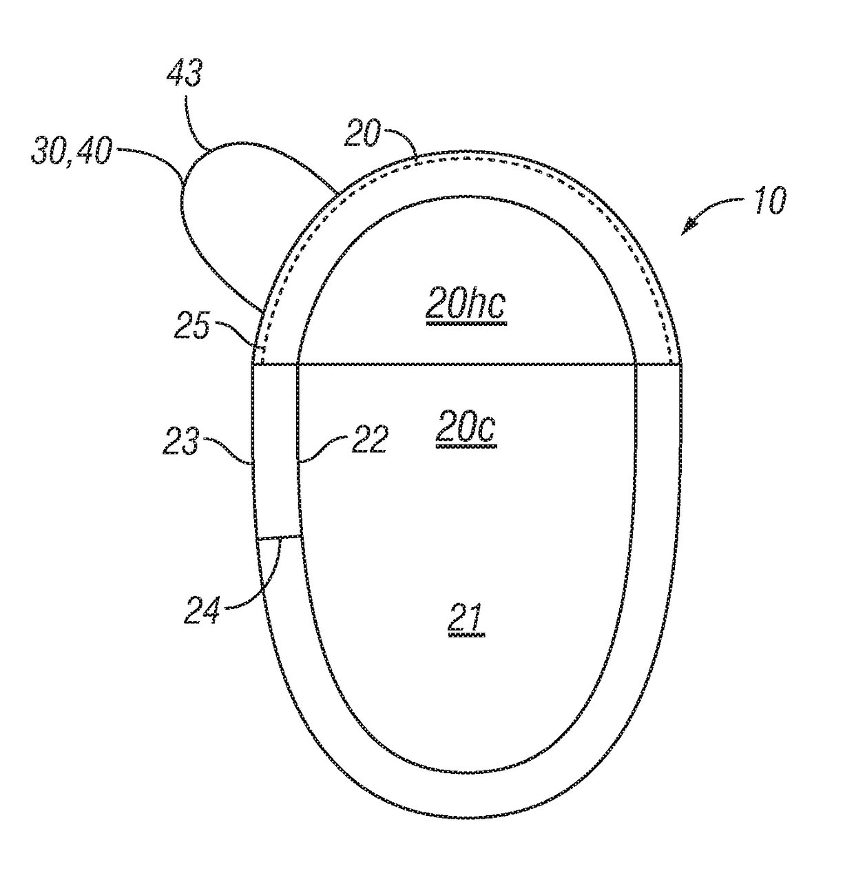 Medical implant housing having attached suture anchors