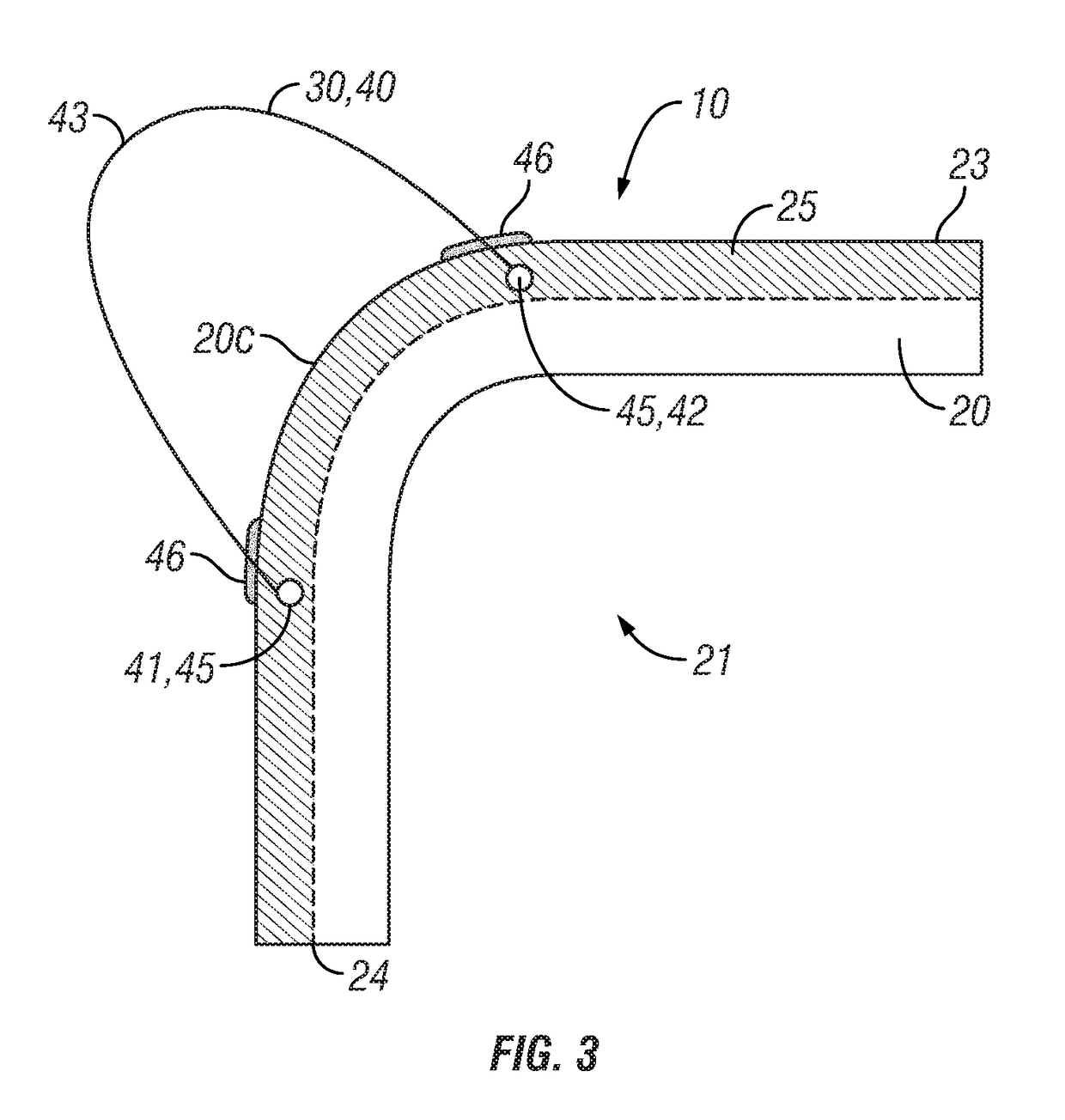 Medical implant housing having attached suture anchors