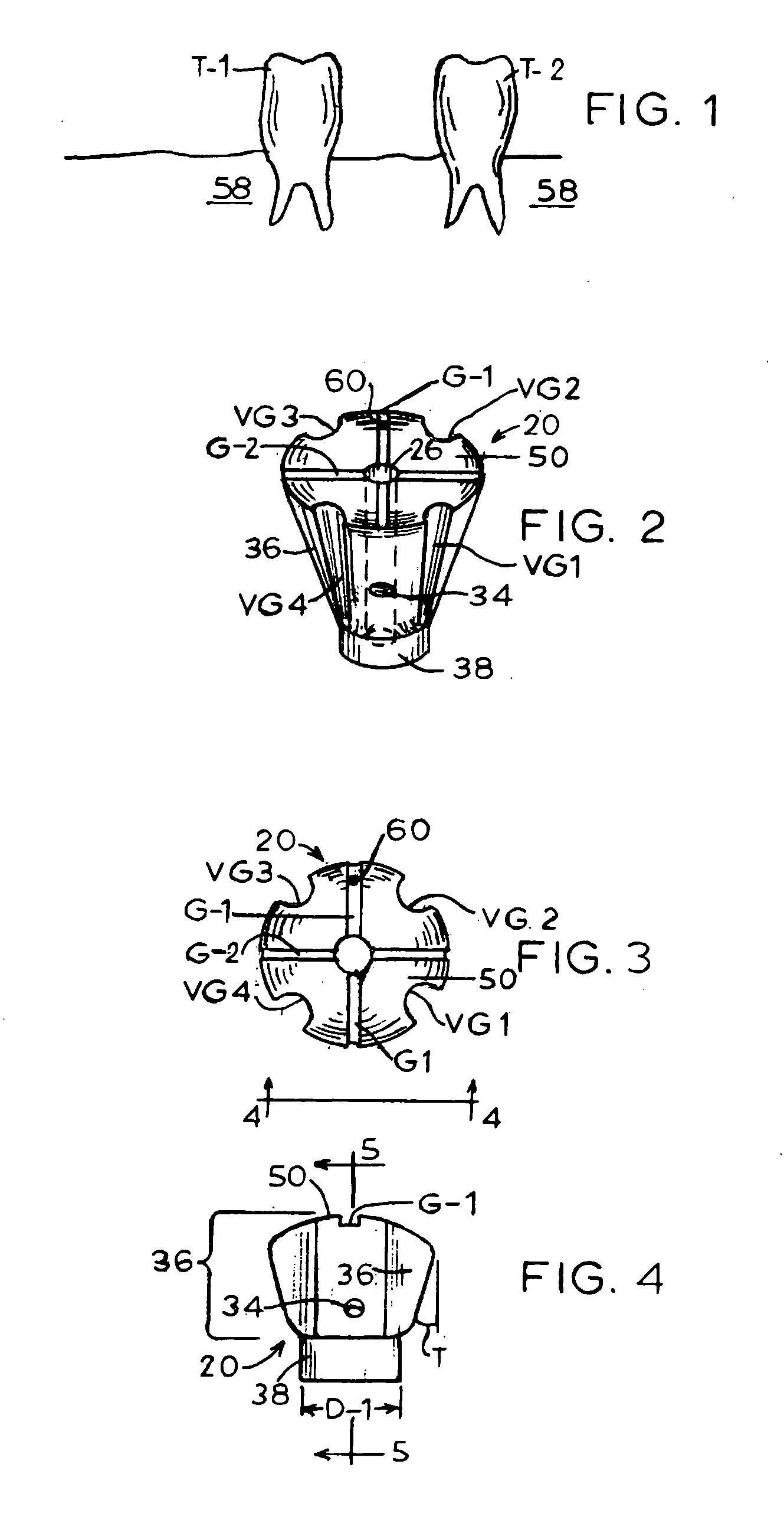 Dental implant drill apparatus and method