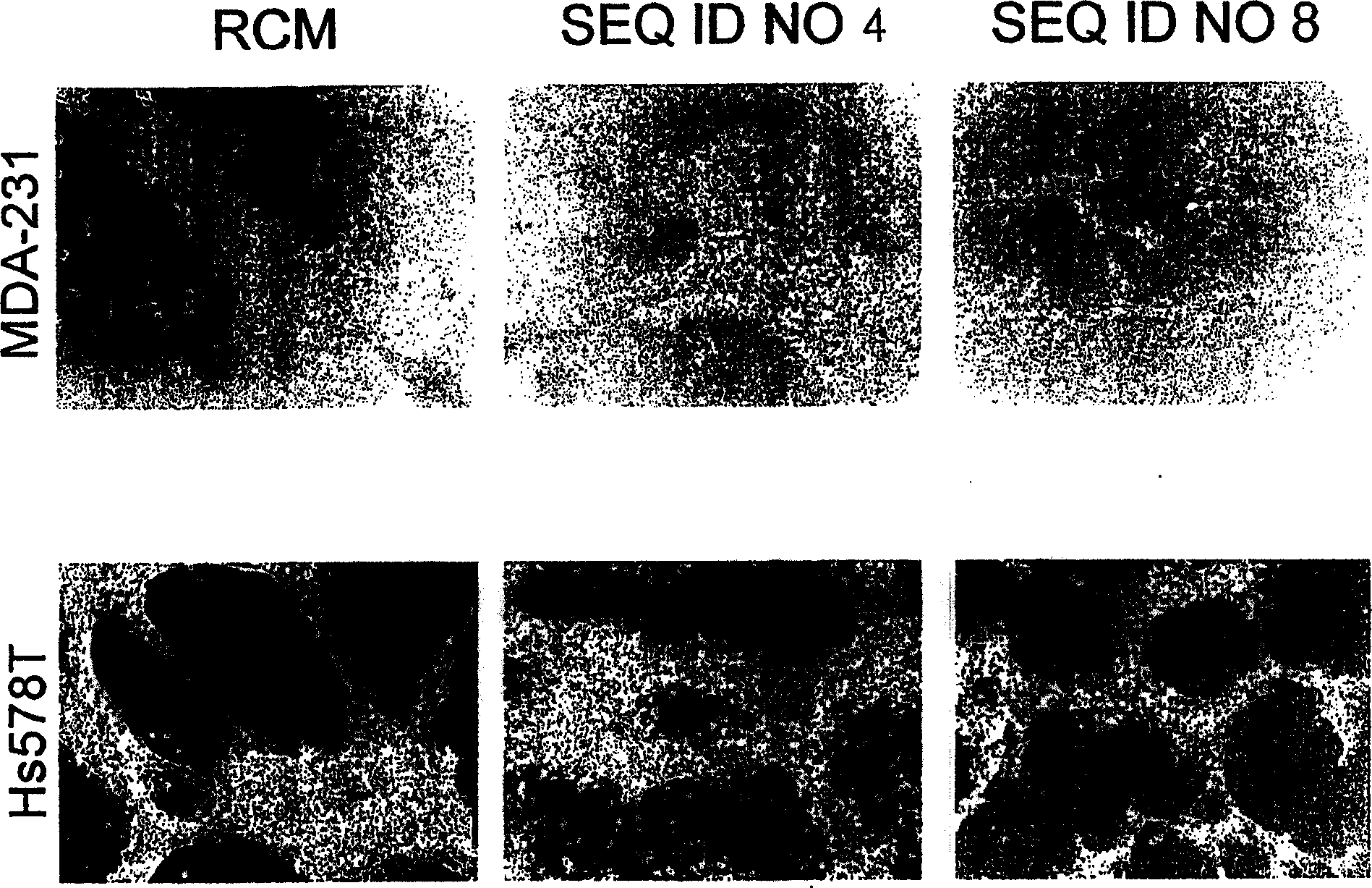 Therapeutically useful triethyleneglycol cholesteryl oligonucleotides