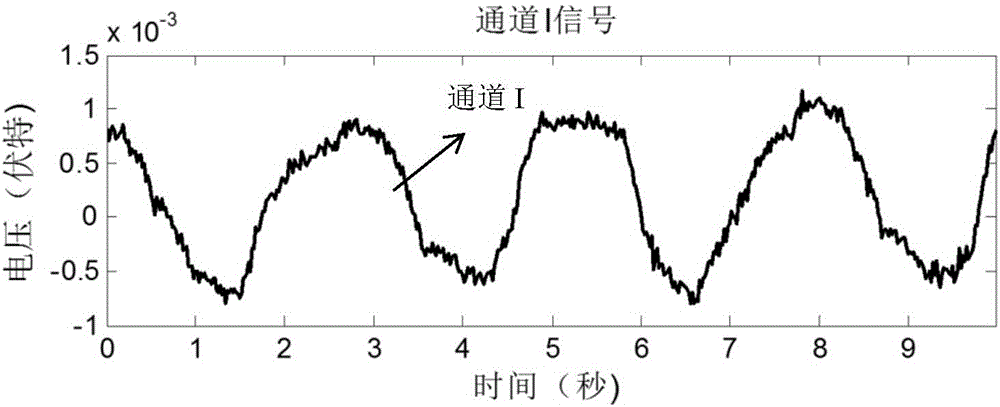 Non-contact life sign monitoring signal processing system