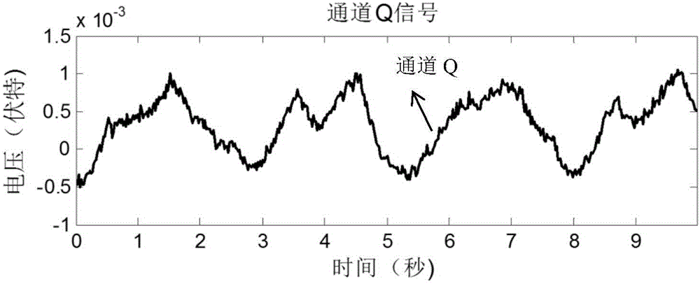 Non-contact life sign monitoring signal processing system