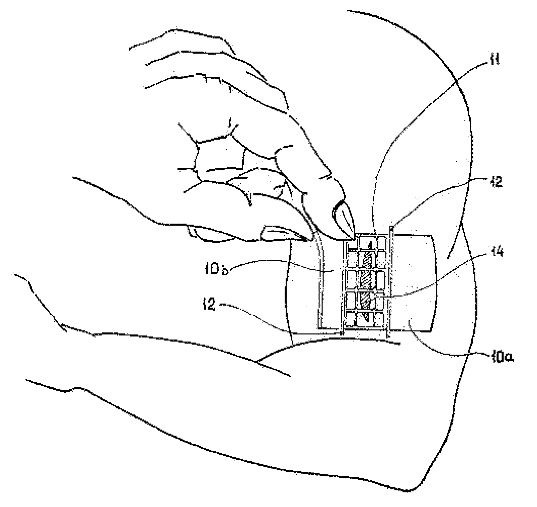 Surgical Bandage & Methods for Treating Open Wounds