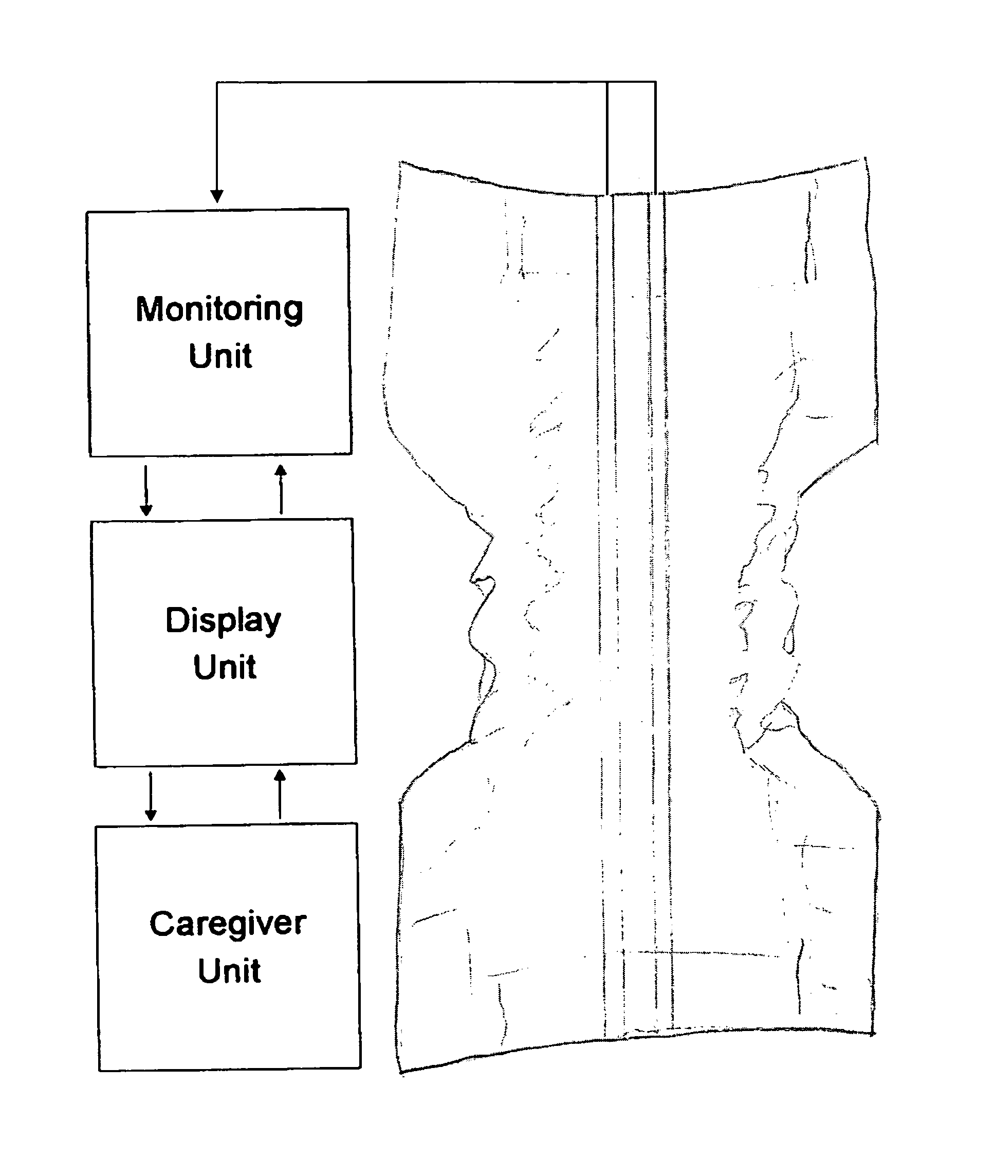 Patient monitoring system