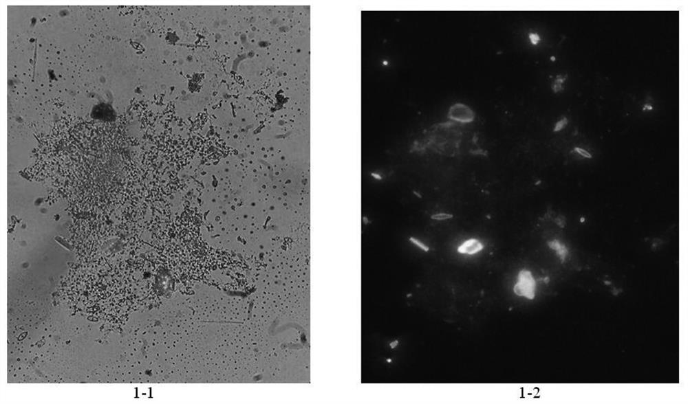 A kind of diatom fluorescent staining solution and diatom detection method for detecting visceral tissue