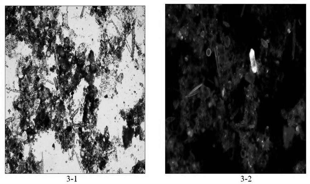 A kind of diatom fluorescent staining solution and diatom detection method for detecting visceral tissue