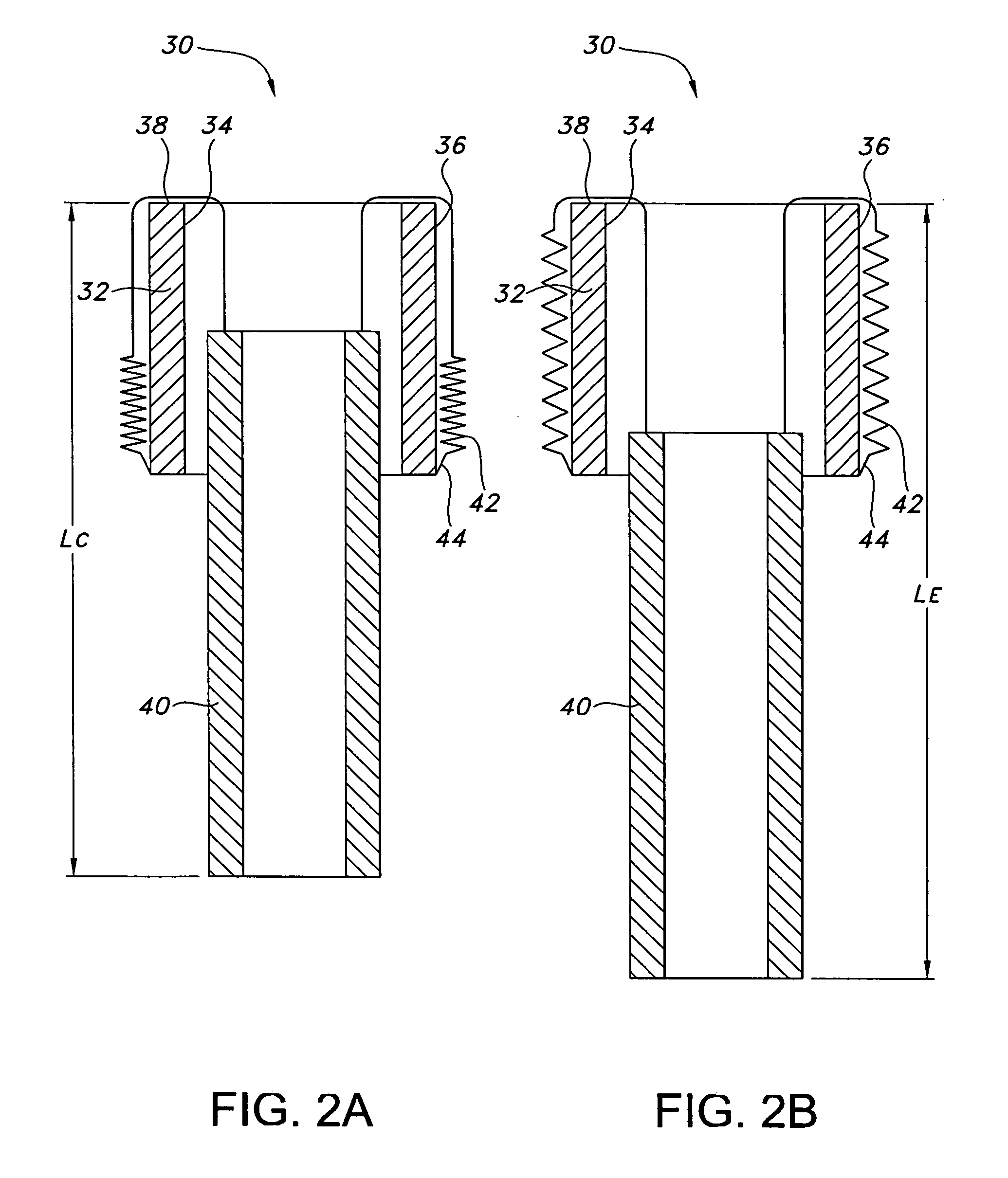 Variable length endovascular graft prosthesis adapted to prevent endoleaks