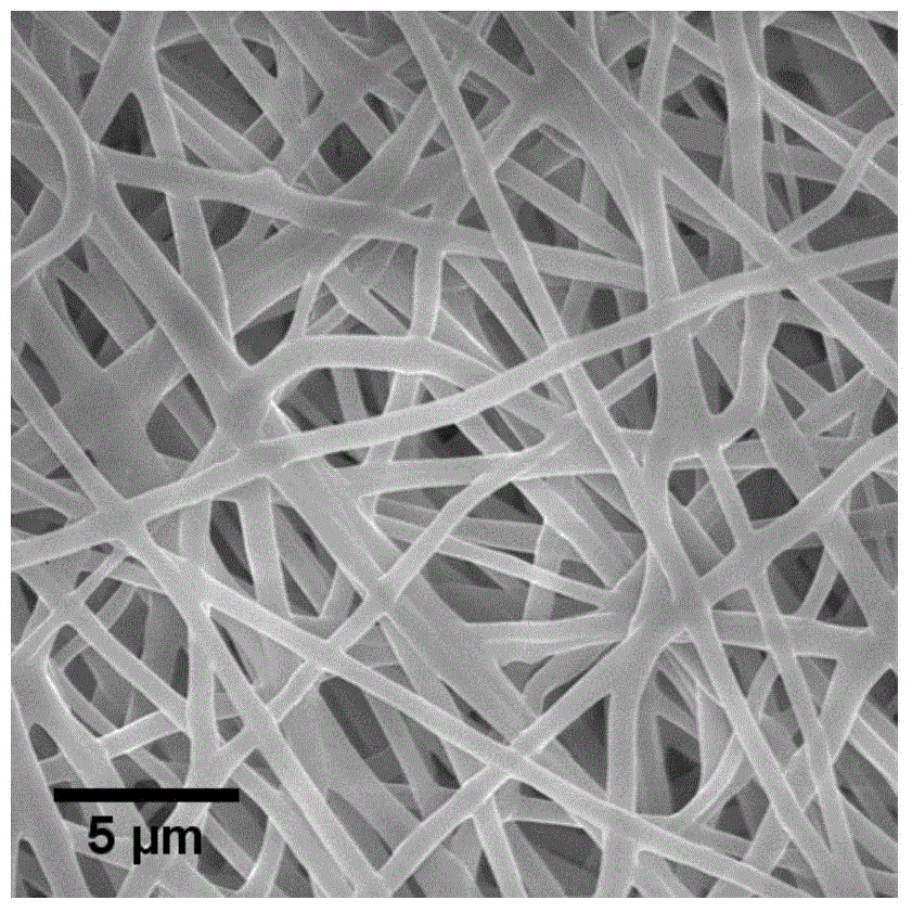 Dipyridamole-loaded polyurethane anticoagulative material and preparation process thereof