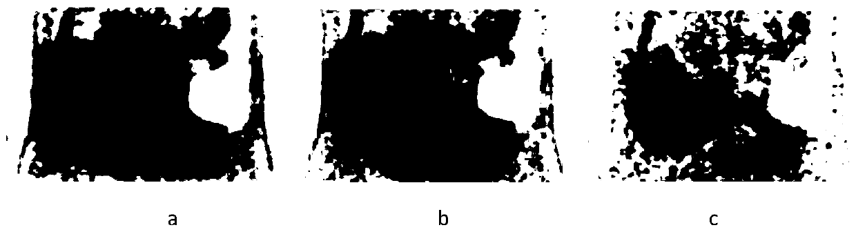 Correction information acquisition method for performing attenuation correction on PET image of breath or heart