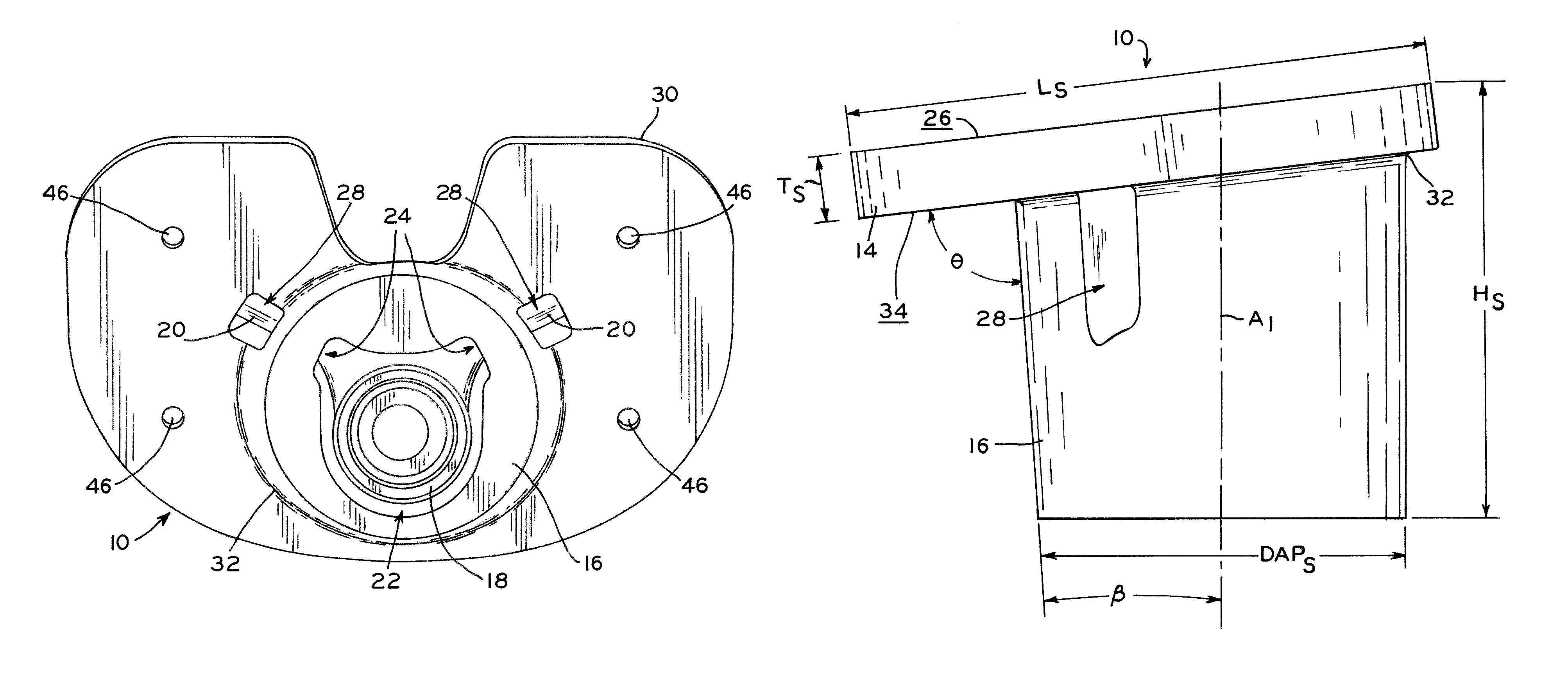 Stabilizing prosthesis support structure