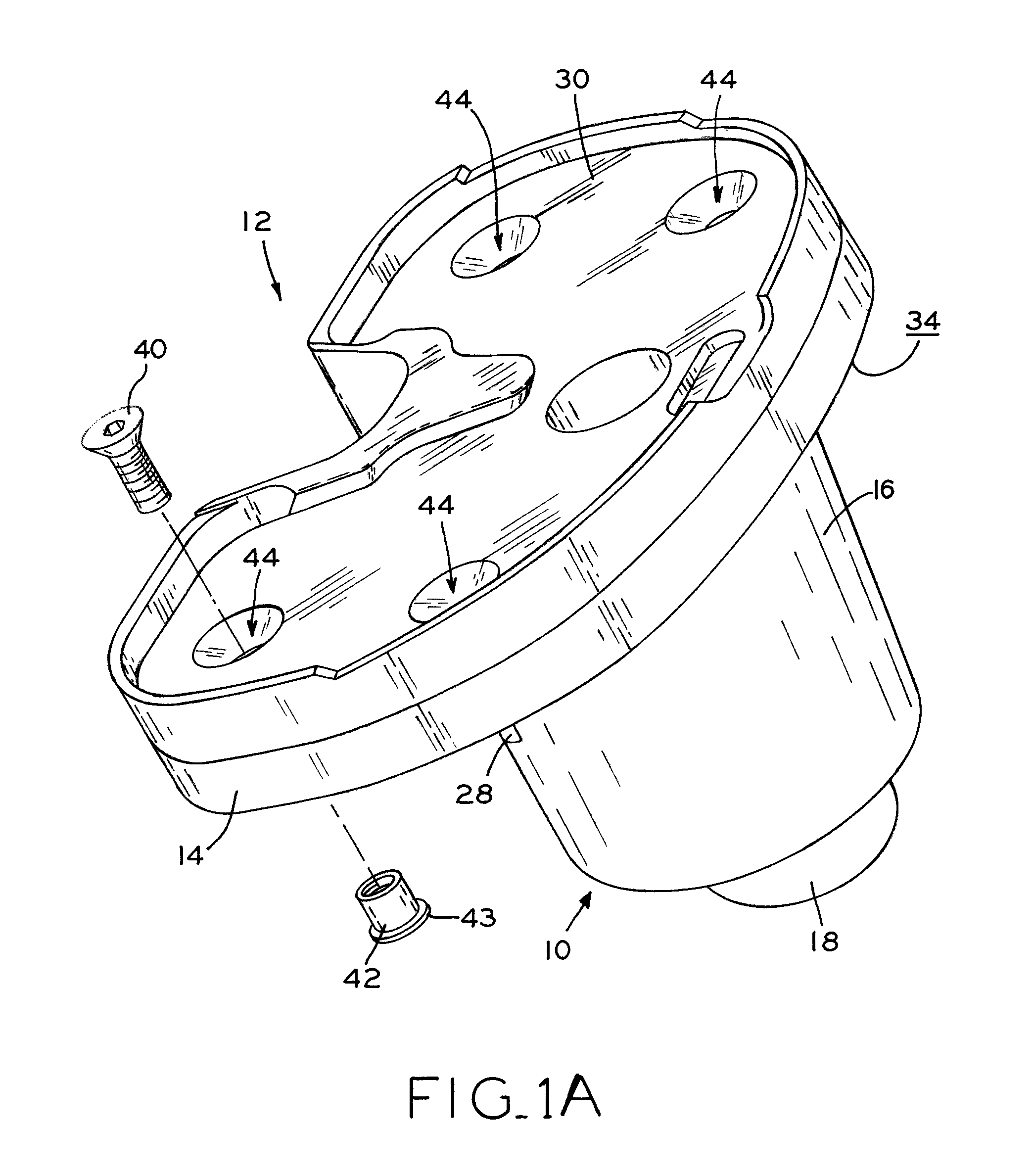 Stabilizing prosthesis support structure